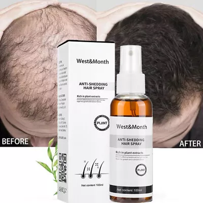 Hair Growth Spray For Men Women 100ml Hair Regrowth Treatment Anti-Hair Loss UK • £5.95