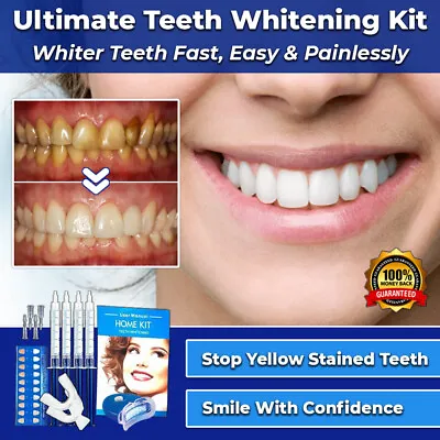 $24.95 • Buy #1 New Teeth Whitening Kit Safe Led White Tooth Clean Gel Bleach Dental Strength