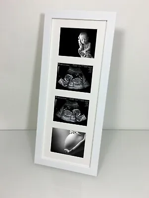 12 & 20 Week 1st Baby Scan 4 Photo Hand Made Frame Freestanding Wall Mountable • £16.95