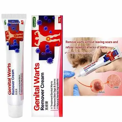 Genital Herpes Wart Remover Ointment Skin Tag Mole Acuminatum Treatment Cream UK • £8.15