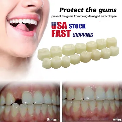 US 50/70Pcs Resin Anterior Dental Temporary Porcelain Crown Veneers Stable Teeth • $8.57