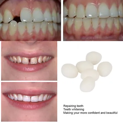 100g Temporary Tooth Repair Kit Fix Teeth And Filling Gap Material Care • £6.29