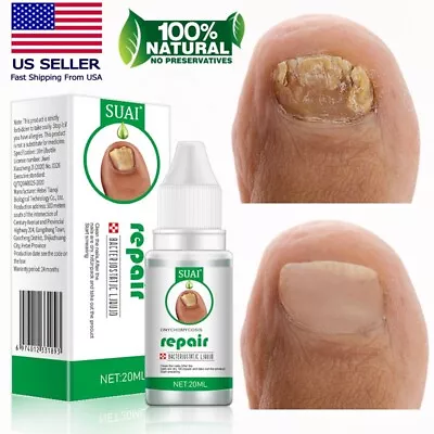 Extra Strength Toenail Fingernail Fungus Treatment Nail Repair Renewal Solution • $8.99
