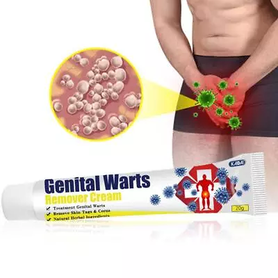 Wart Remover Genital Ointment Herpe Cream Skin Tag Mole Antibacterial Treatment • £4.39