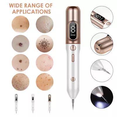 Electric Laser Plasma Mole Removal Pen Dark Spot Remover Skin Wart Tag Tattoo US • $19.70