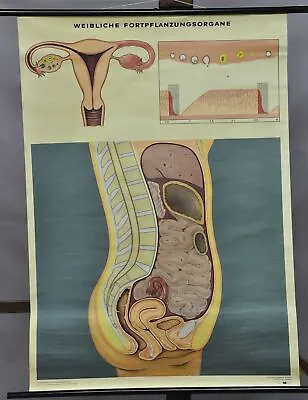 Vintage Poster Medical Pull-down Wall Chart Female Reproductive Organ • $215.99