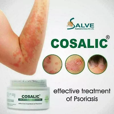 COAL TAR & SALICYLIC ACID OINTMENT COSALIC For Treating Skin PSORIASIS 50gm UK • £14.99