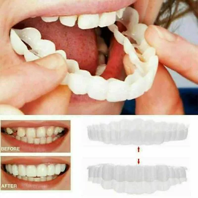 Smile False Tooth Cover Snap On False Teeth Upper&Bottom Dental Veneers Dentures • $10.88