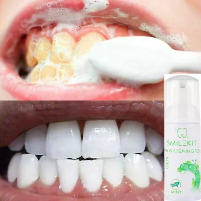 £6.95 • Buy Teeth Whitening Toothpaste,Foam Toothpaste,Remove Tooth Plaque For Oral Cleaning