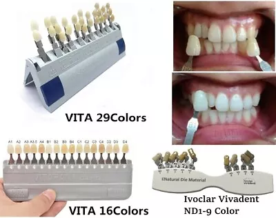 Dental Teeth Shade Guide Natural Die Materia ND1-9 Color Chart VITA 16&29 Colors • $17.99