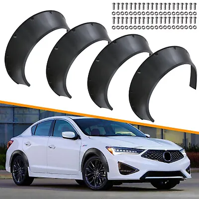 Car Fender Flares Fits For Acura ILX RSX TL Wheel Arches Extended Wide Body Kit  • $65.99