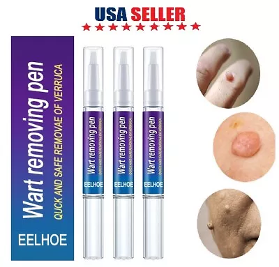 4× Painless Wart Remover Pen Eliminate Skin Tag Foot Corn Mole Warts Restoration • $6.92