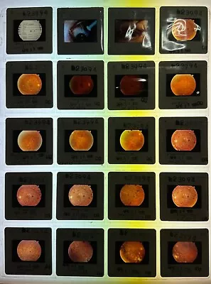 Vintage EYEBALLS Color Photo Slides EYES Lot Of 20 Oddities Medical #B9 • $19.50