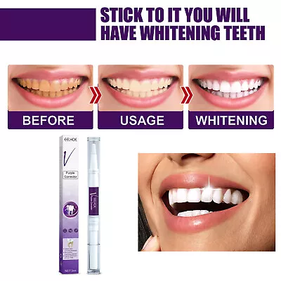 $11.75 • Buy Hismile V34 Colour Corrector Teeth Whitening Gel Pen, Tooth Stain Removal 1/2PC