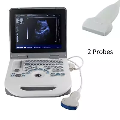 12  Portable Laptop 3D Full Digital Ultrasound Scanner Convex + Linear 2 Probes • $1699
