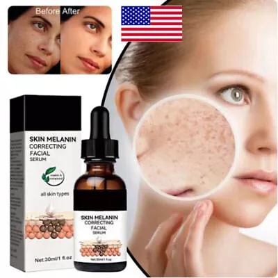 Hyperpigmentation Correcting Facial Serum GFOUK Melanin Correcting Facial 30ml • $8.03