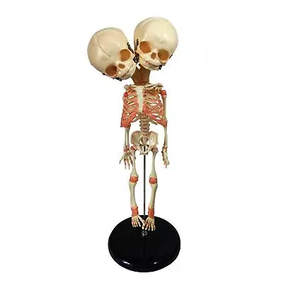 Baby Deformed Head Skull Model With Base Educational Equipment For Schools • £35.29