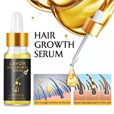 LAVDIK Ginger Fast Hair Growth Serum Essential Oil Anti Preventing Hair Lose • £4.99