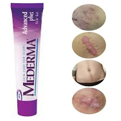 ORIGINAL MEDERMA ADVANCED PLUS SCAR GEL FOR SCARS & MARKS - No1 - Free Shipping • $16.73