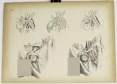 Medical Anatomy Colored Lithograph Print 1850s Vintage Antique 14.25x10.25 #46 • $46.93