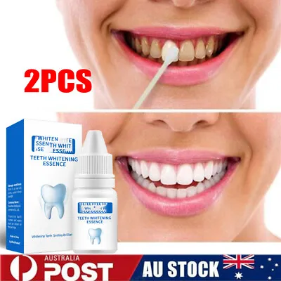 $11.65 • Buy New Instant Tooth Whitening  White Teeth Clean Gel Uv Bleach Dental Strength