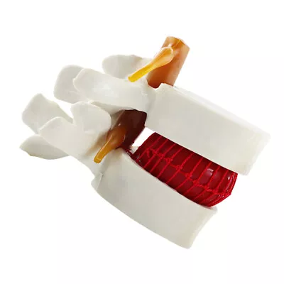 Spine Skeleton Model Anatomy Model Chiropractor Lumbar Spine Model • $22.79