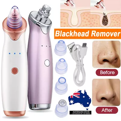 $9.99 • Buy Face Facial Pore Blackhead Remover Vacuum Derma Suction Diamond Dermabrasion MN