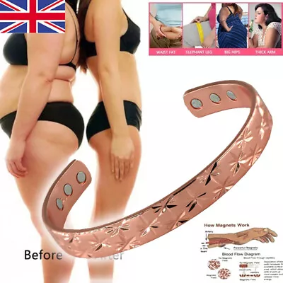 Copper Magnetic Bracelet Mens Ladies Bio Pain Relief Arthritis Healing Bangle UK • £5.69