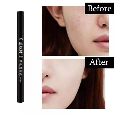 Vitiligo Scars Birthmarks Cover Pen Waterproof Long Makeup C5Z4 • $2.69