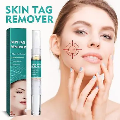 12 Hours Wart Remover Pen Skin Tag Mole Eliminate Foot Corn Warts Unisex Pack1-5 • $2.99