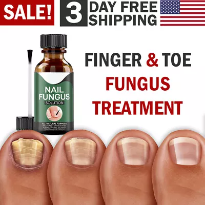 Nail Fungus Antifungal Home Treatment For Toe And Finger Nails Fungal Infections • $8.99