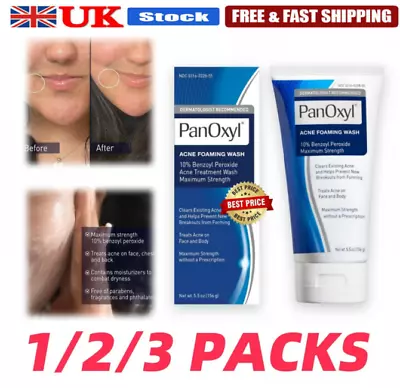 Acne Foaming Wash Face & Body 10% Active Ingredient 156ml Moisture New UK • £31.19