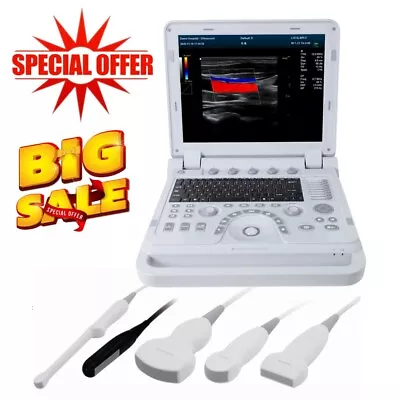 Portable Ultrasound Scanner Laptop Machine Color Doppler Convex Linear Cardiac • $790