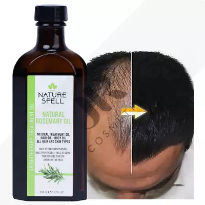 Nature Spell ROSEMARY Oil | #1 Best Seller For Hair Growth | Hair Loss Treatment • £16.99