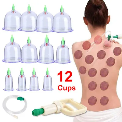 $13.99 • Buy 12 Cups Set Medical Chinese Body Vacuum Cupping Healthy Suction Therapy Massage