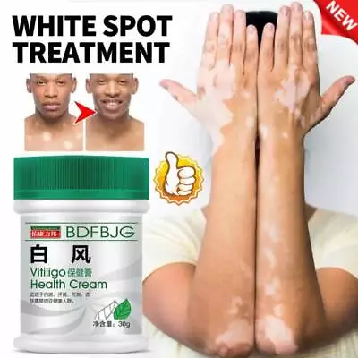 Vitiligo Fix Revitalize ElixirTreatment Cream Treat Vitiligo Soothing Cream' • $4.36