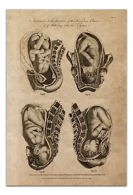 Anatomy MIDWIFERY BABY IN WOMB (PLATE 3) Vintage Illustration 22x15  Art Print • $20.99