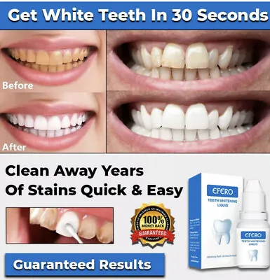 $24.99 • Buy New Instant Tooth Whitening Kit White Teeth Clean Gel Uv Bleach Dental Strength