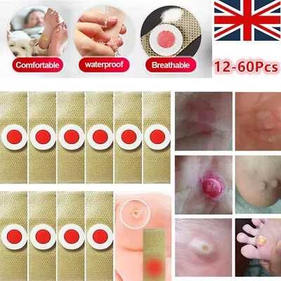 60 * Foot Corn Remover Pads Plantar Wart Thorn Plaster Patch Callus Removal - UK • £7.97