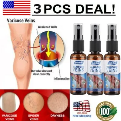 3Pcs Veinhealing Varicose Veins Treatment Spray Veinhealing Varicose Veins Spray • $12.78