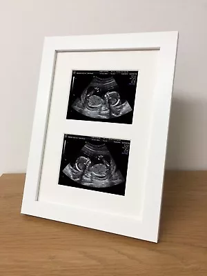 Double Baby Ultrasound Pregnancy Scan / 1st Photo UK Hand Made White Frame • £11.95