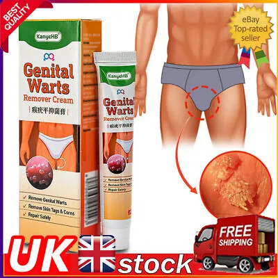 Genital Herpes Remover Cream For Warts Skin Tags Moles Fast-Acting Treatment • £5.79