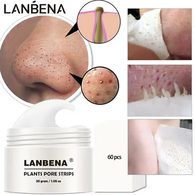 $9.85 • Buy LANBENA Blackhead Remover Cream Facial Nose Pack Plant Pore Strips Acne Peel Off