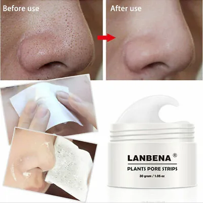 LANBENA Pore Strips Blackhead Remover Cream Nose Acne Clean Peel OFF Mud Mask • £7.95