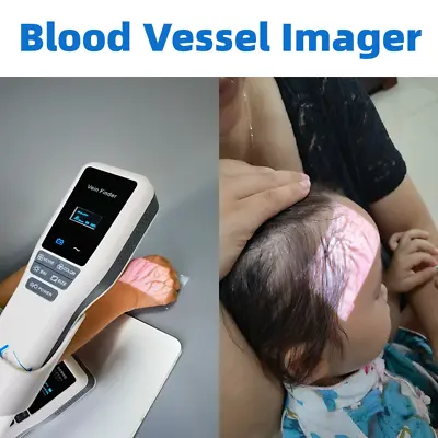 Vein Finder Locator Handheld Portable Near-Infrared Blood Vessel Display Nurse • $1140