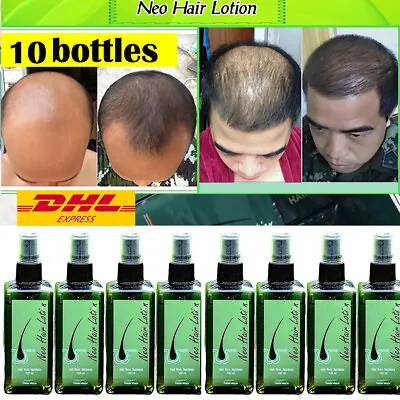 Neo Hair Lotion 120ml Hair Root Hair Beard Sideburns Longer 100% Herbs 10X • $254.05