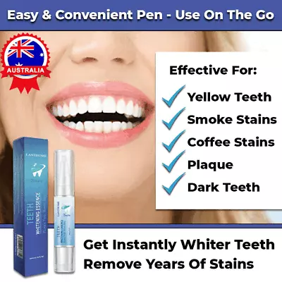 $9.10 • Buy Instant Tooth Whitening Pen White Teeth Clean Gel Uv Bleach Dental Strength New