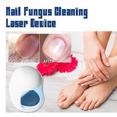 Nail Fungus Laser Device Light Therapy Onychomycosis Toes Treatment • $2.94