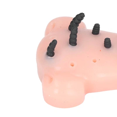 £14.79 • Buy Pimple Popper Toy Pimple Squeezing Toy Stress Relive Blackheads Removal