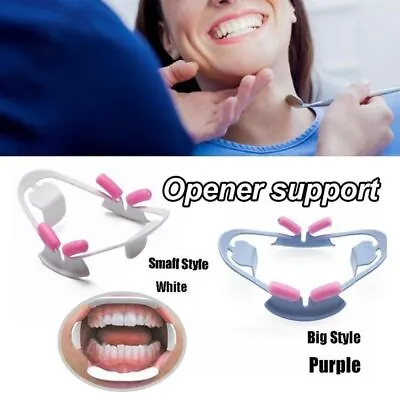 3D Mouth Opener Orthodontic Dental O Shape Cheek Retractor Oral Cheek Lip Opener • £3.22